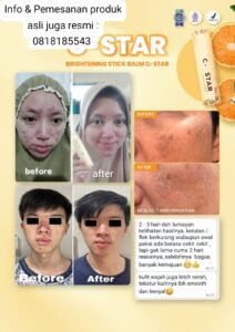 serum c star